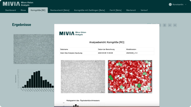 MiViA Korngrößenanalyse